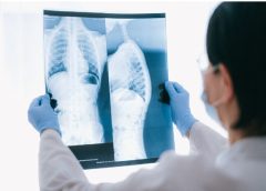 Common Symptoms of Lung Disease and When to See a Pulmonologist